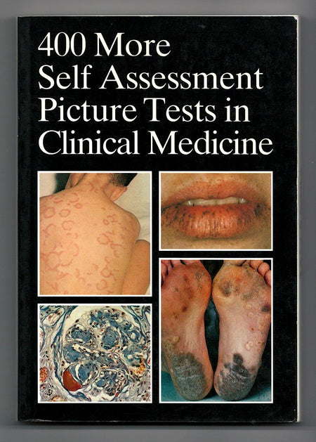 400 More Self Assessment Picture Tests in Clinical Medicine
